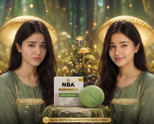 NBA Anti Acne Soap